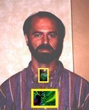 Why isn't he smiling? Click box for an x-ray.